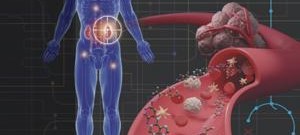 LetPub Journal Cover Art Design - Circulating succinate-modifying metabolites accurately classify and reflect the status of fumarate hydratase–deficient renal cell carcinoma